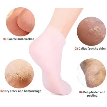 2 komada silikon njegu stopala, čarape anti-pukotine hidratantni gel čarape pukotine mrtve kože ukloniti zaštitnik boli alati za pedikuru 